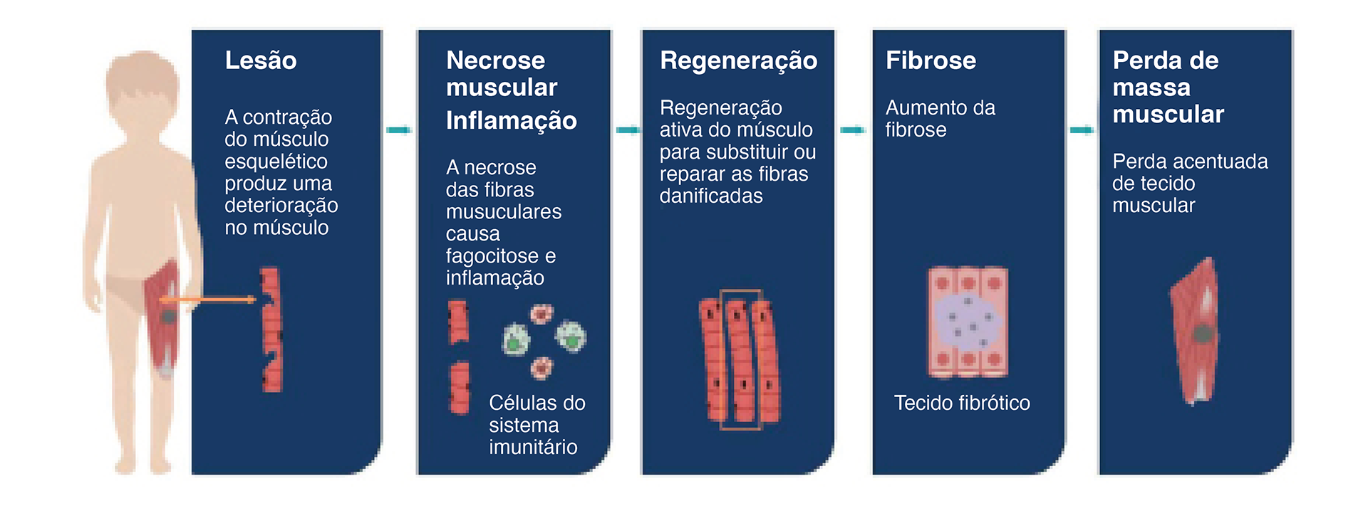 esquema